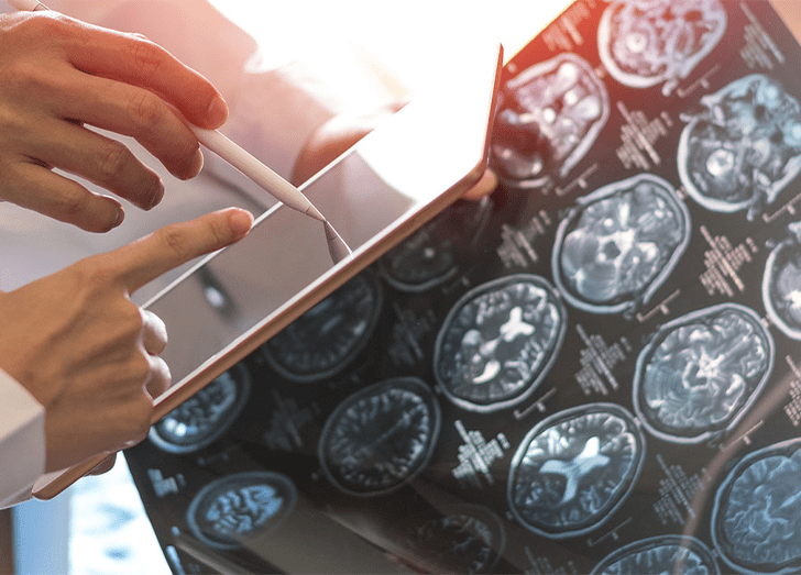 Harvard Neuro-oncology